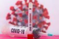 Kto a ako rozhoduje o očkovaní proti koronavírusu?